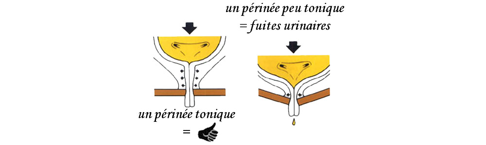 Fuite urinaire et périnée